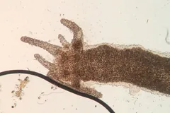 Hydra under a microscope with stubby tentacles around its mouth