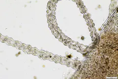 Close view of a hydra's beaded tentacles under a microscope